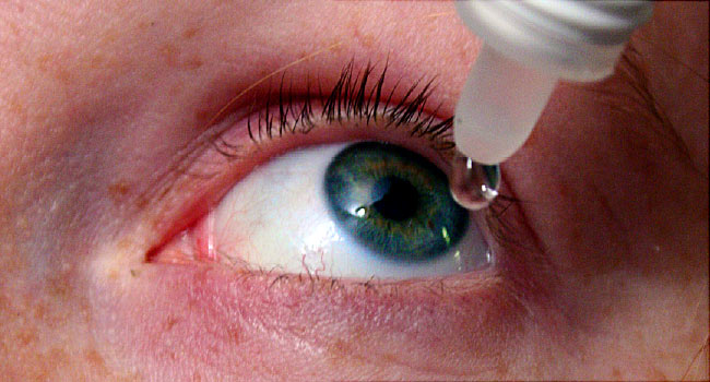Image result for dry eye